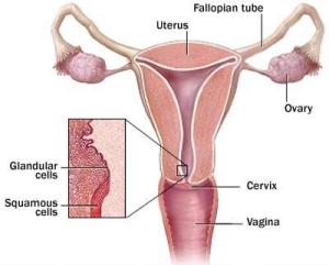 Kanker-Vagina